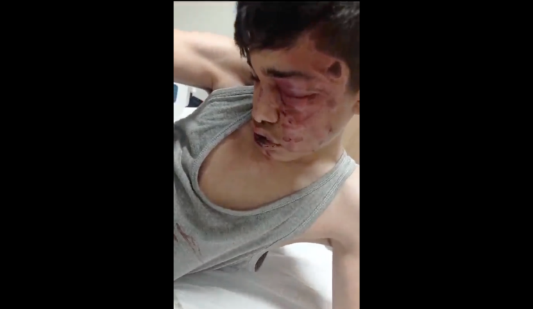 Suriyeli çocuğa işkence: Dövüldü, kaçırıldı, dili yakıldı, vücuduna anahtar sokuldu, öldü sanılıp yol kenarına atıldı…